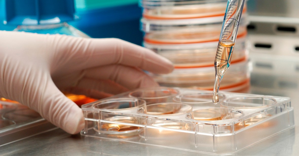 Research specialist Lia Thornberry Kent works under a fume hood dispersing a feeder solution necessary to maintain growing stem cell cultures in researcher James Thomson's lab at the University of Wisconsin-Madison. Thomson, a developmental biologist and professor of anatomy, directed the research group that reported the first isolation of embryonic stem cell lines from a nonhuman primate in 1995, work that led his group to the first successful isolation of human embryonic stem cell lines in 1998. ©UW-Madison University Communications 608/262-0067 Photo by: Jeff Miller Date: 8/05 File#: D100 digital camera frame 10734